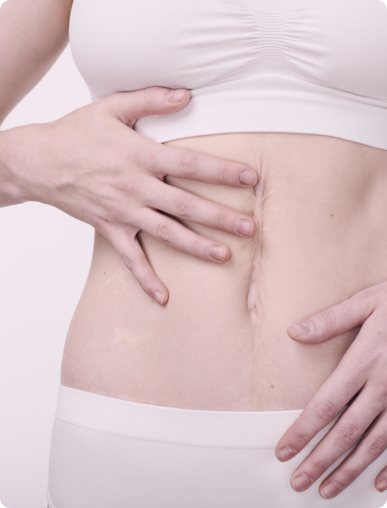 Cicatrices: recupera la vitalidad de tu piel