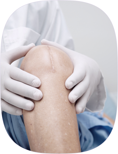 Cicatrices: recupera la vitalidad de tu piel